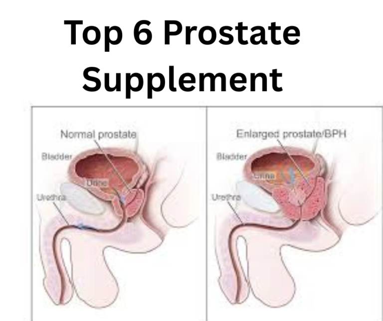 Top 6 Prostate Supplement